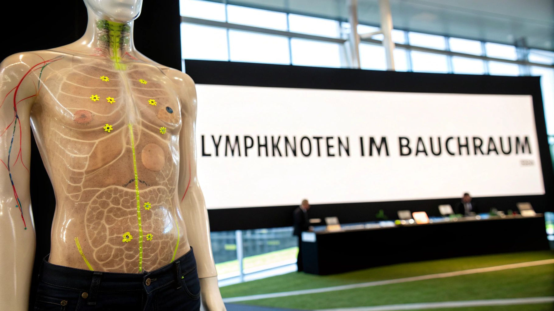 Lymphknoten im Bauchraum verstehen und einordnen
