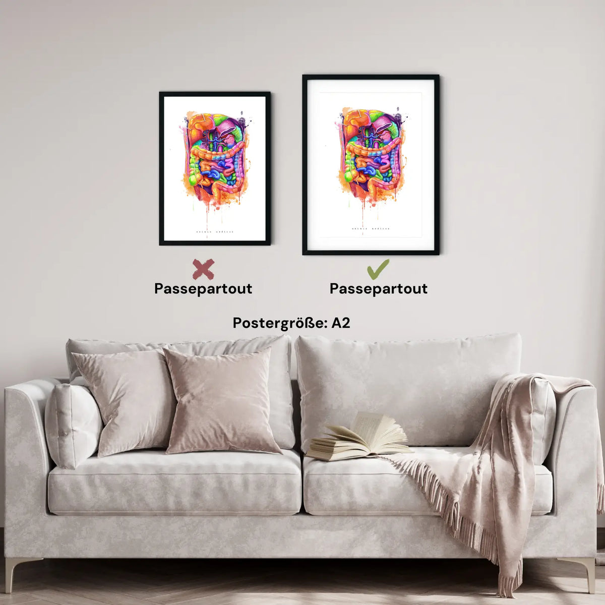 Abdomen Anatomie - Rainbow - Animus Medicus GmbH