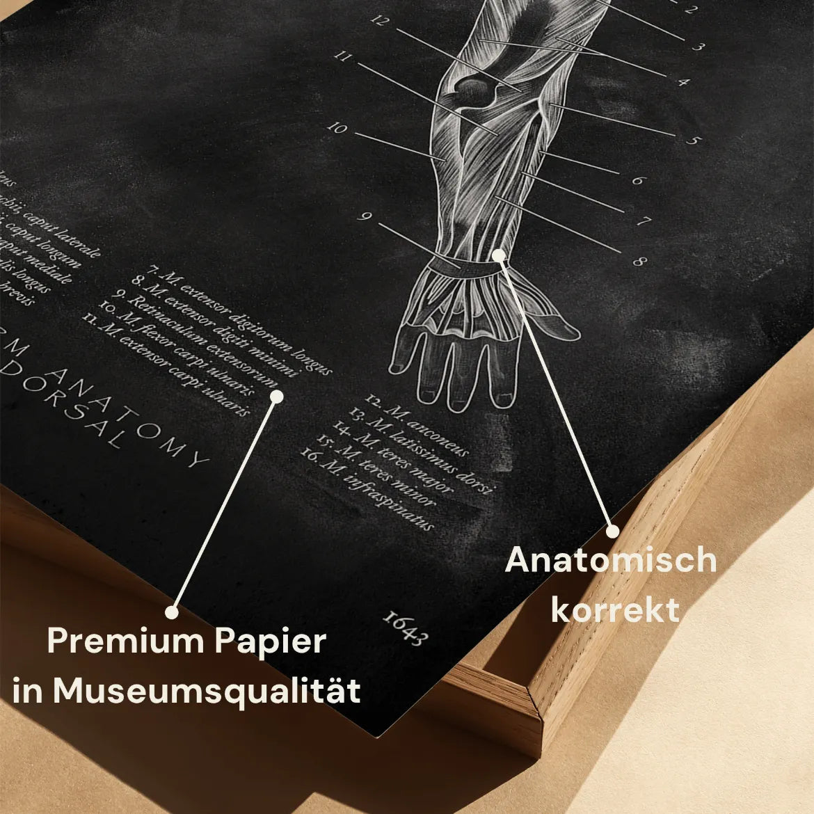 Arm Anatomie dorsal - Chalkboard - Animus Medicus GmbH