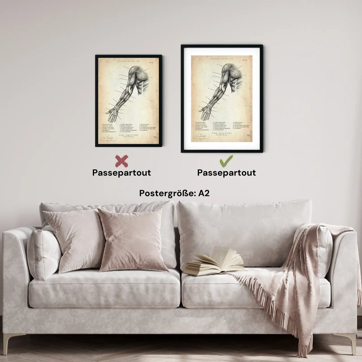 Arm Anatomie ventral - Animus Medicus GmbH