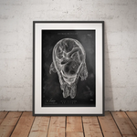 Baby in Gebärmutter - Chalkboard - Animus Medicus GmbH