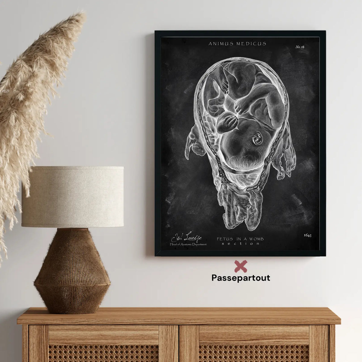 Baby in Gebärmutter - Chalkboard - Animus Medicus GmbH