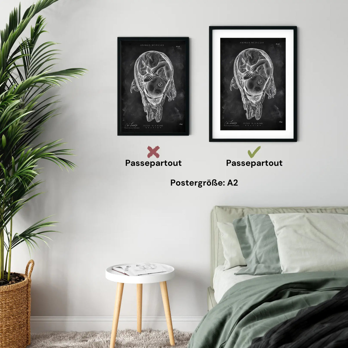 Baby in Gebärmutter - Chalkboard - Animus Medicus GmbH