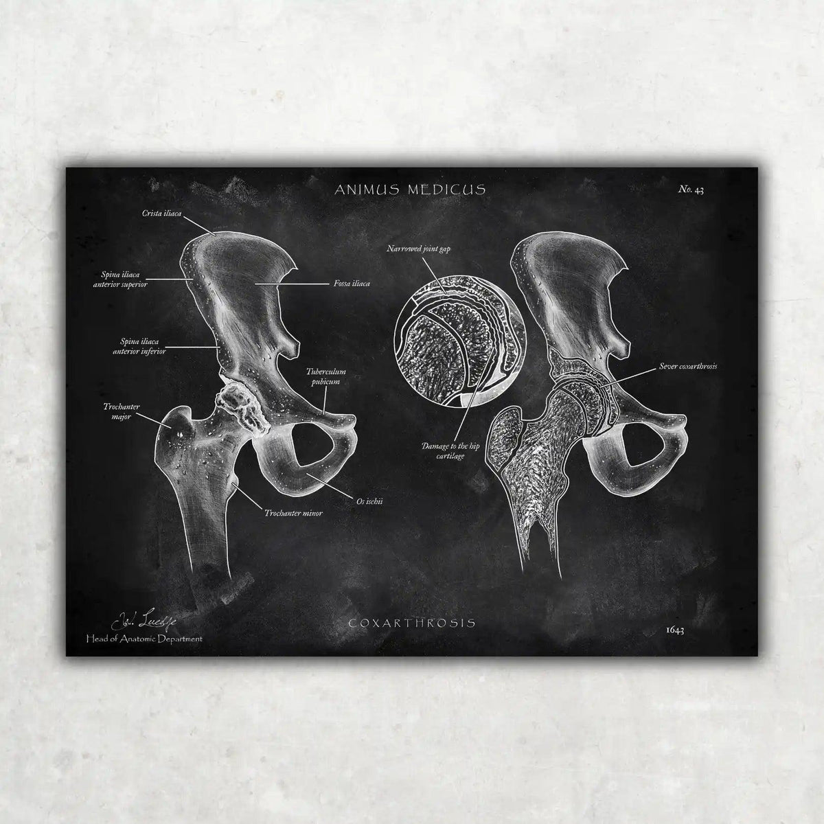 Becken Anatomie Sammlung - Chalkboard - Animus Medicus GmbH