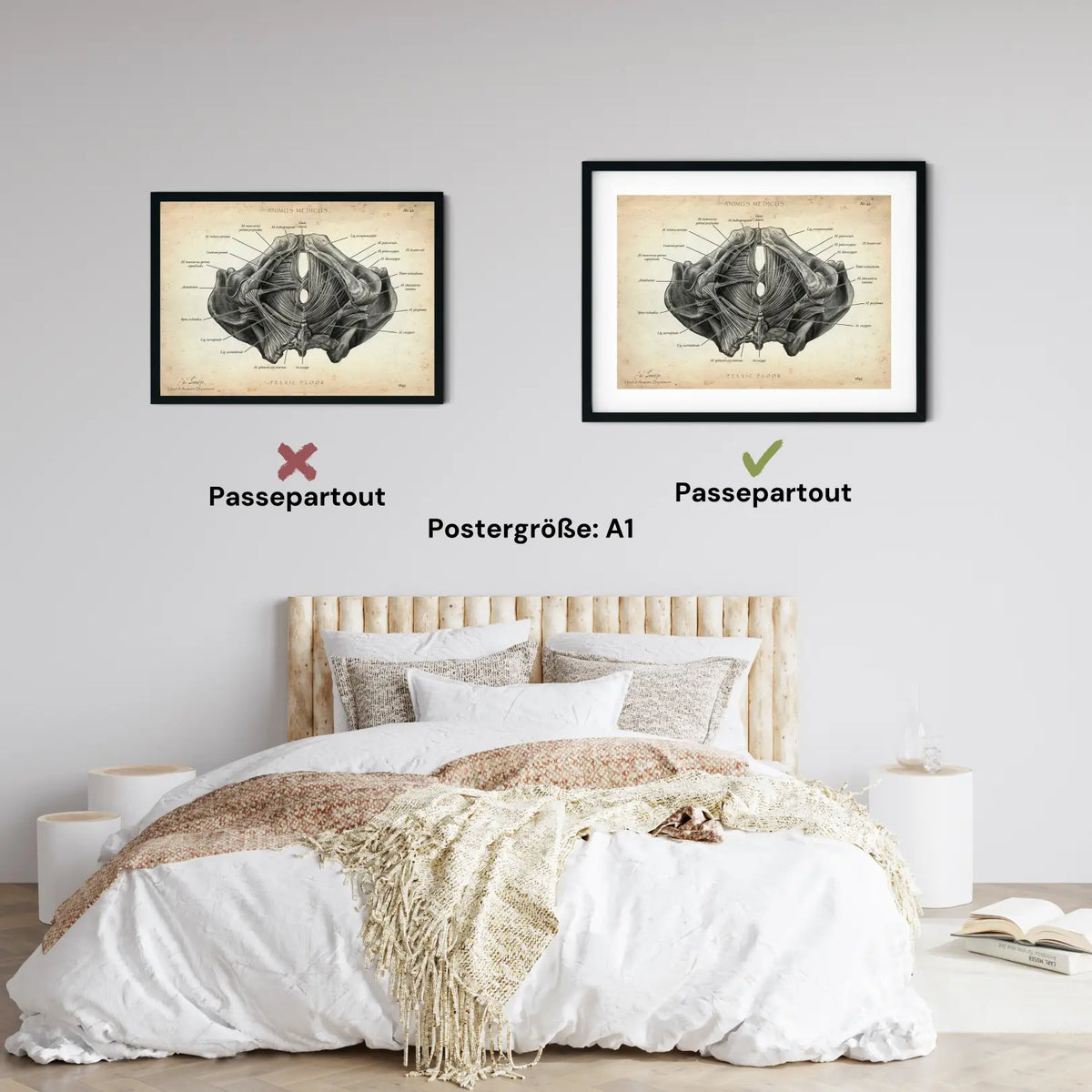 Beckenboden Muskulatur - Animus Medicus GmbH