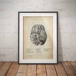 Circulus arteriosus willisii - Animus Medicus GmbH