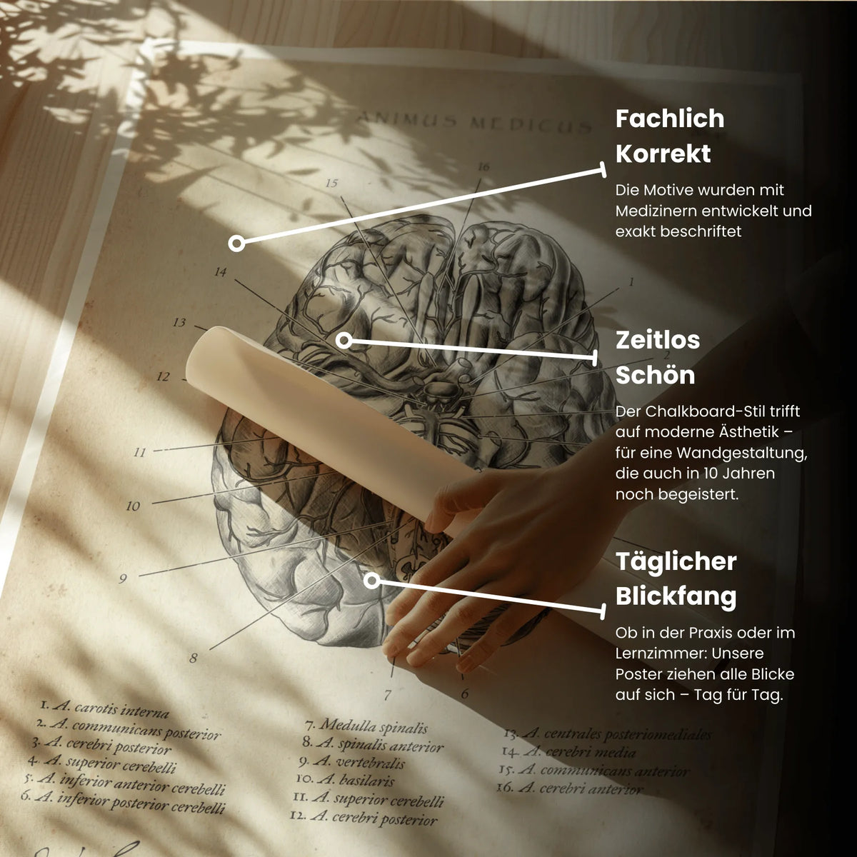 Circulus arteriosus willisii - Animus Medicus GmbH