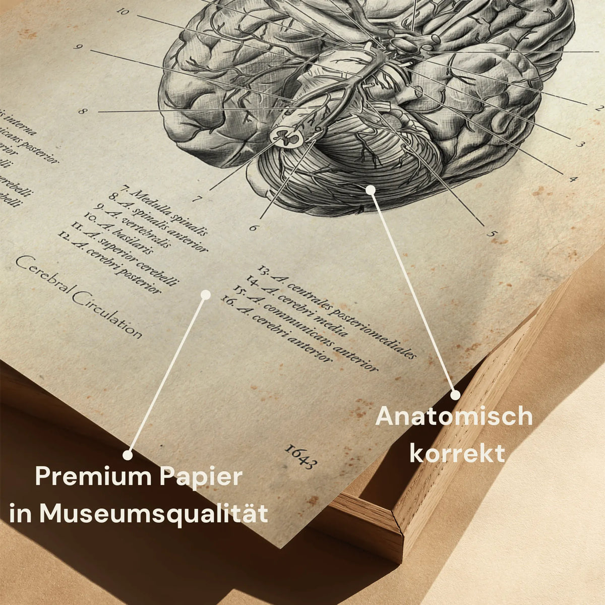 Circulus arteriosus willisii - Animus Medicus GmbH