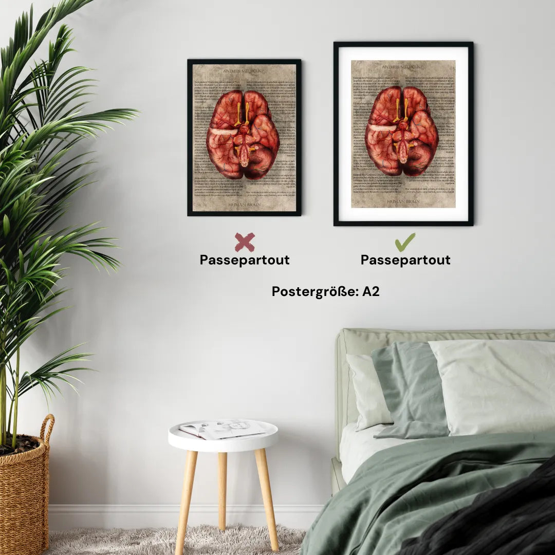 Das Gehirn - Buchseite - Animus Medicus GmbH