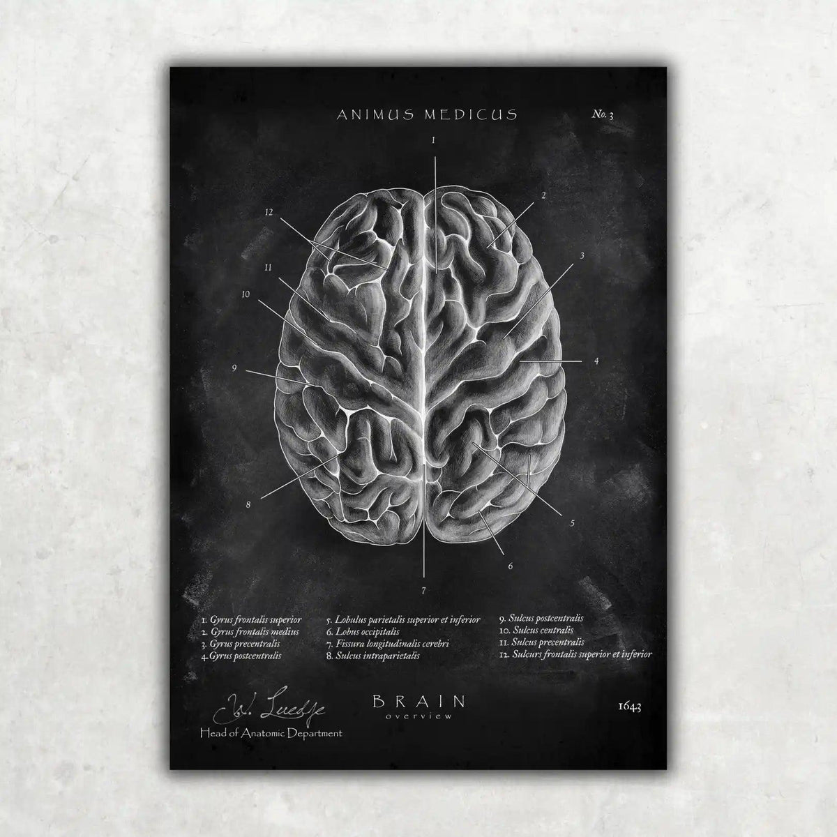 Das menschliche Gehirn - Chalkboard - Animus Medicus GmbH