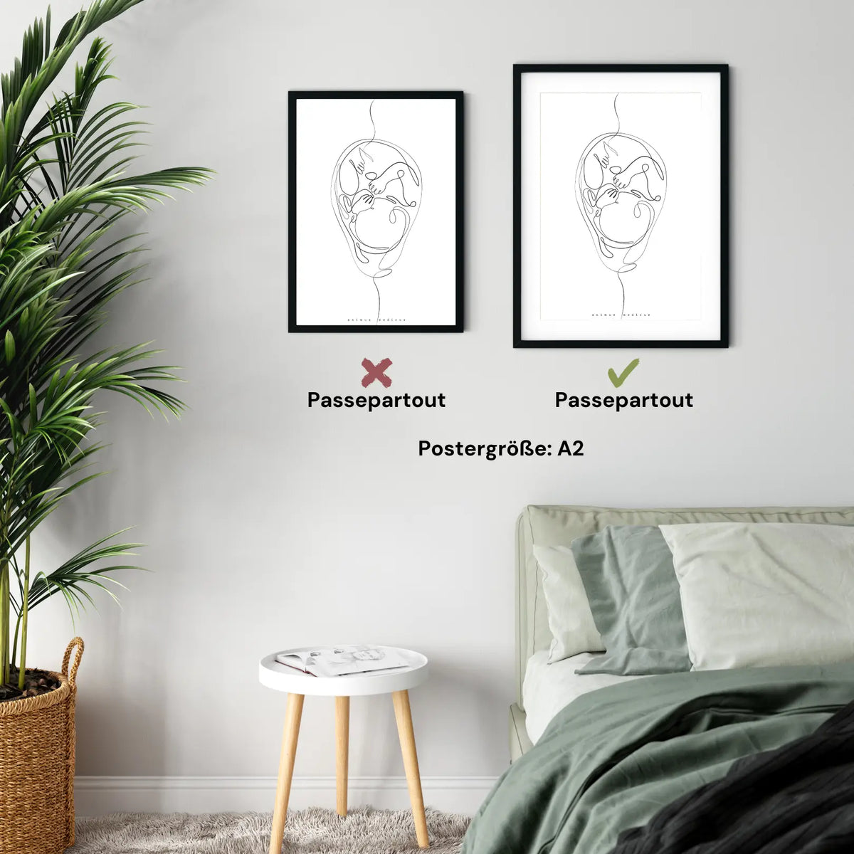 Fetus Anatomie Minimalist - Animus Medicus GmbH