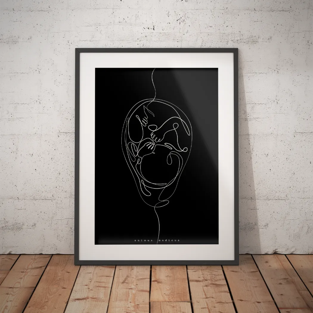 Fetus Anatomie Minimalist Dark - Animus Medicus GmbH