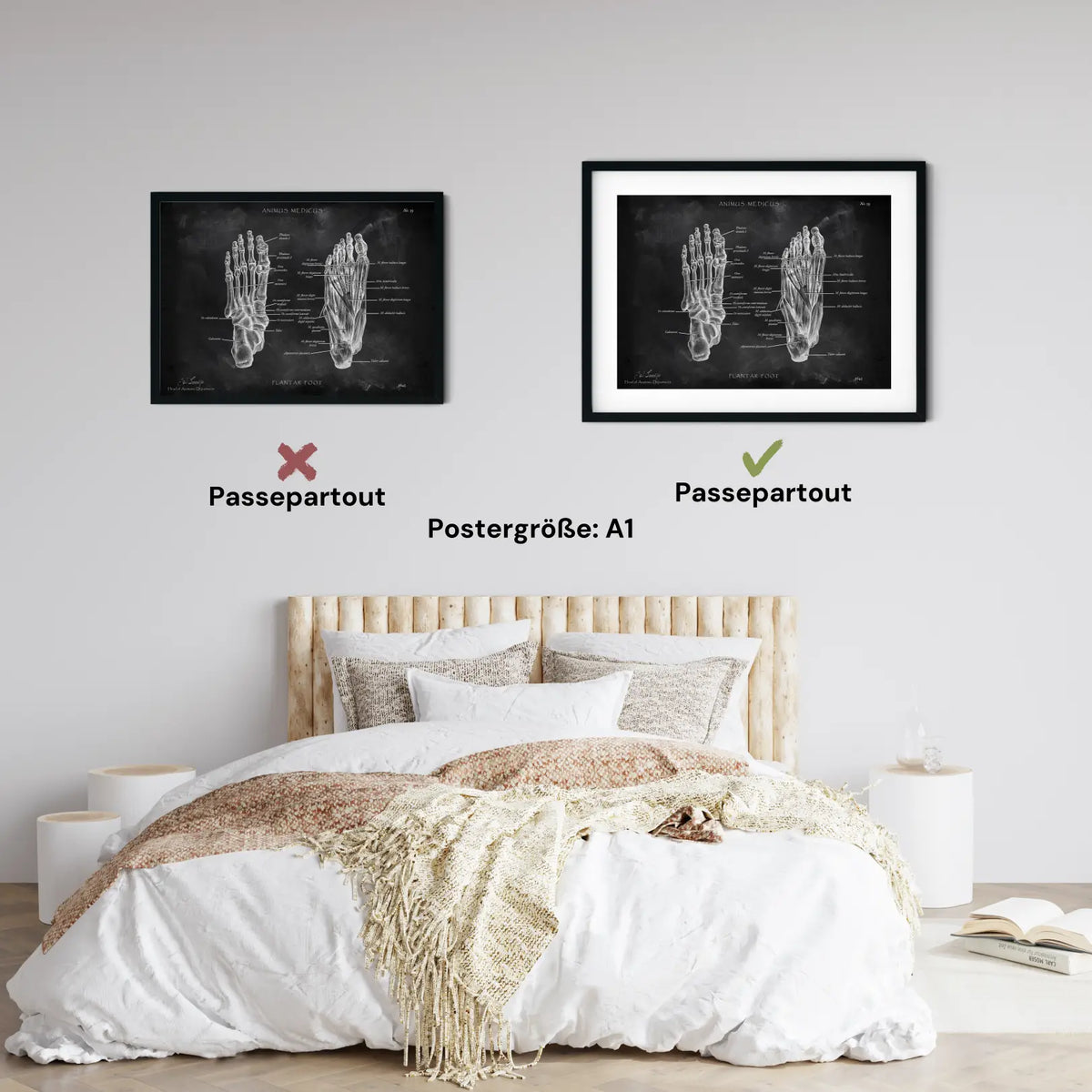 Fuß Anatomie | Knochen und Muskeln - Chalkboard - Animus Medicus GmbH