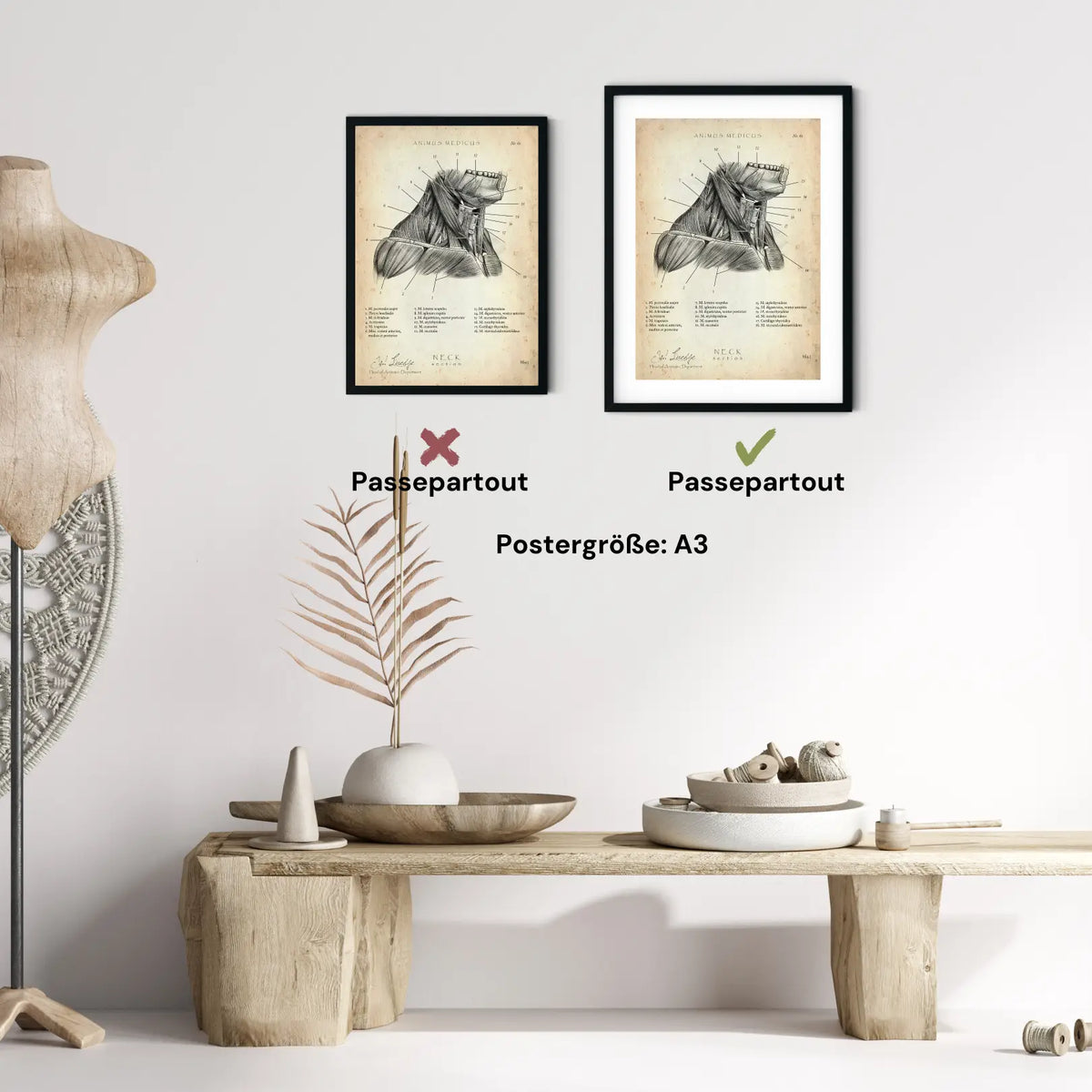 Halsmuskeln im Schnitt - Animus Medicus GmbH