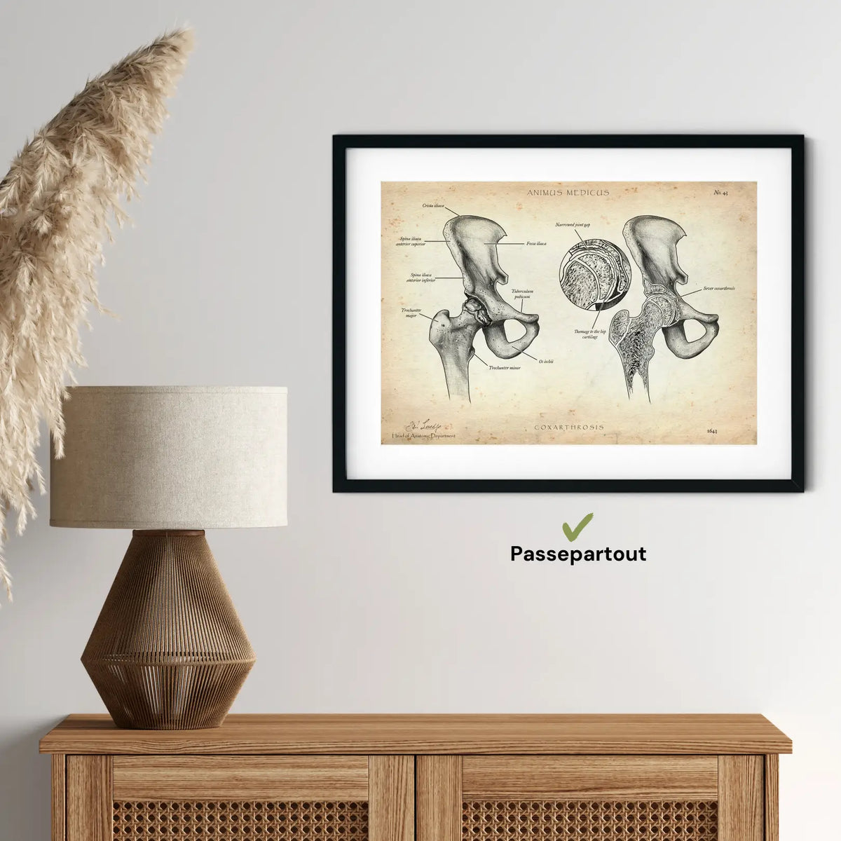 Hüftarthrose - Animus Medicus GmbH