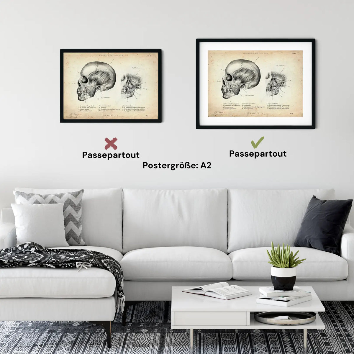 Kaumuskulatur Anatomie - Animus Medicus GmbH
