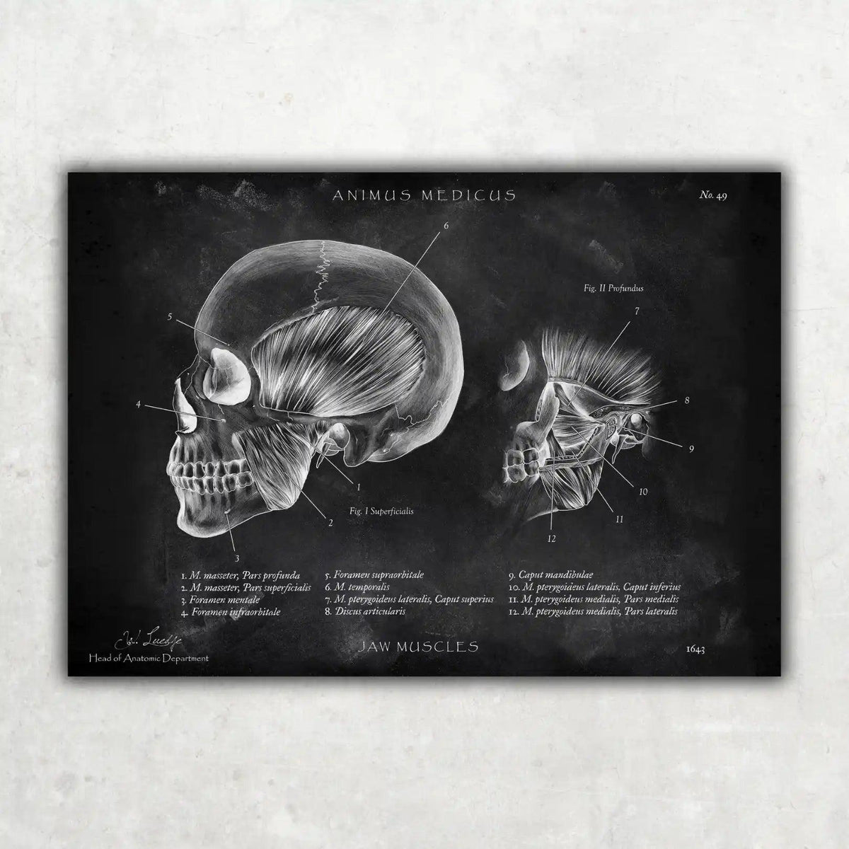 Kaumuskulatur Anatomie - Chalkboard - Animus Medicus GmbH