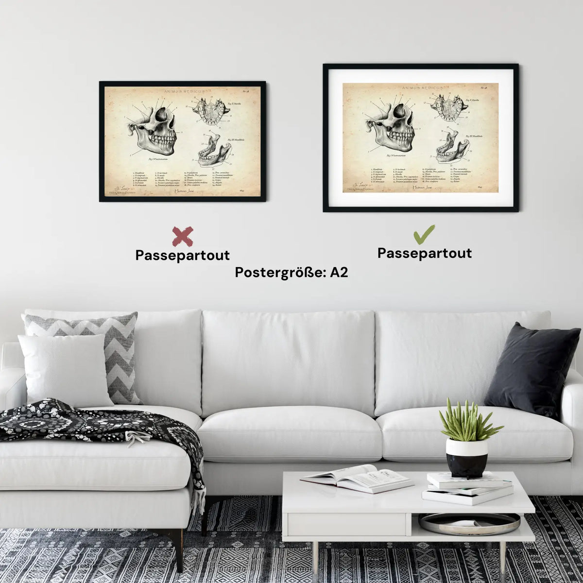 Kiefergelenk Anatomie - Animus Medicus GmbH