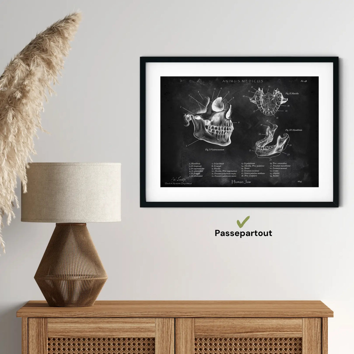 Kiefergelenk Anatomie - Chalkboard - Animus Medicus GmbH