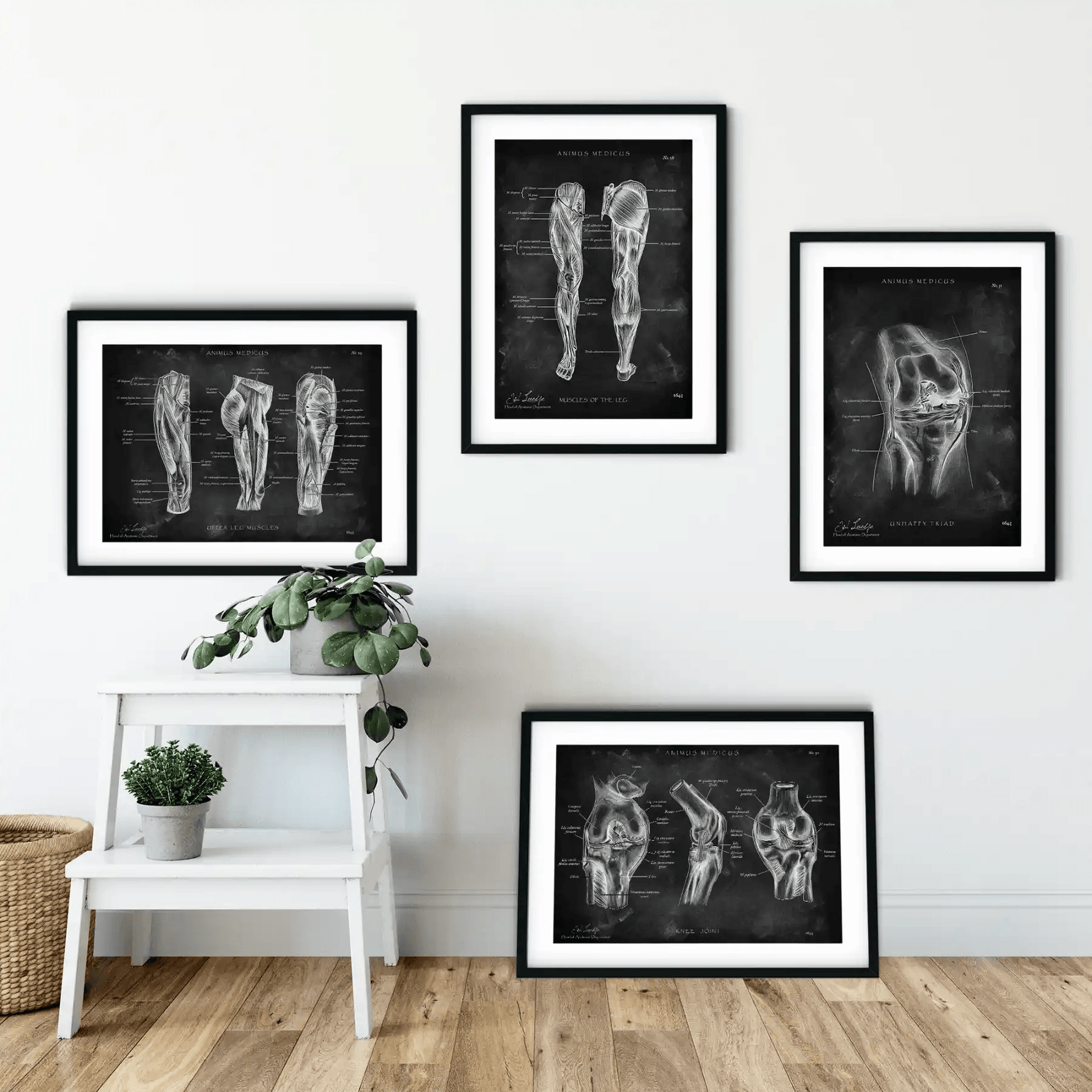 Knie Anatomie Sammlung - Chalkboard - Animus Medicus GmbH