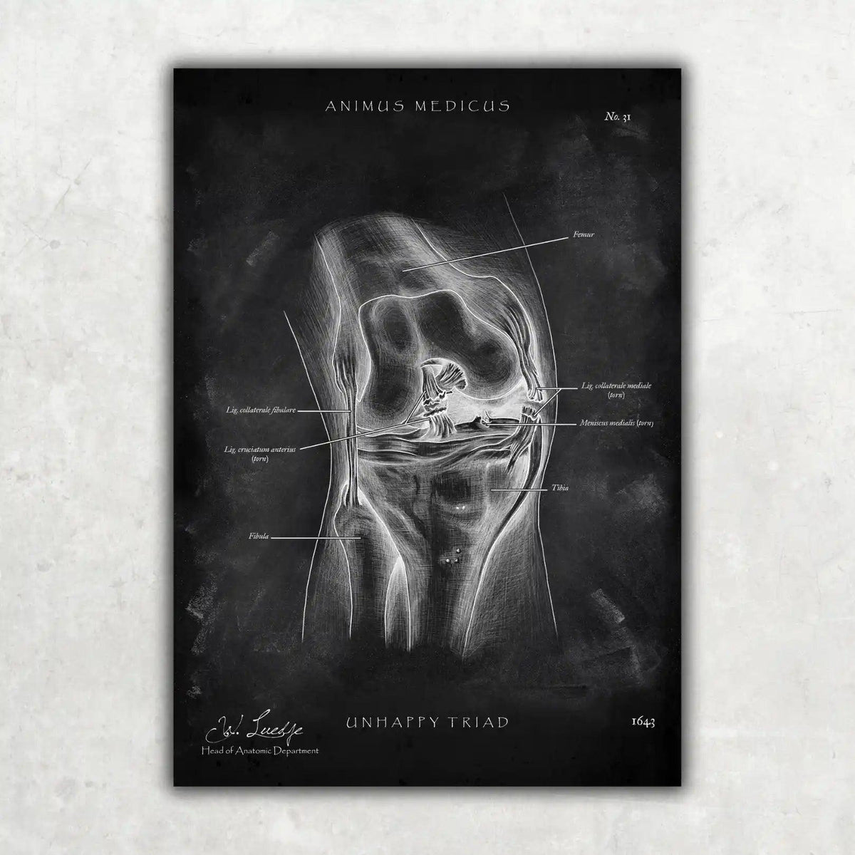 Knie Anatomie Sammlung - Chalkboard - Animus Medicus GmbH