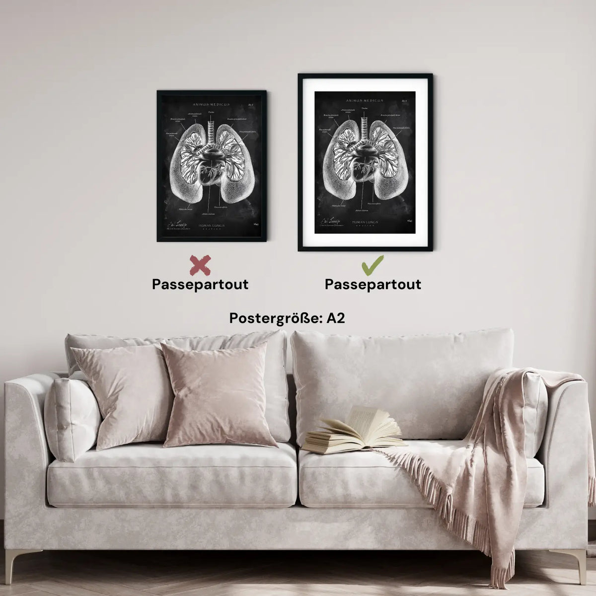 Lungen Anatomie - Chalkboard - Animus Medicus GmbH