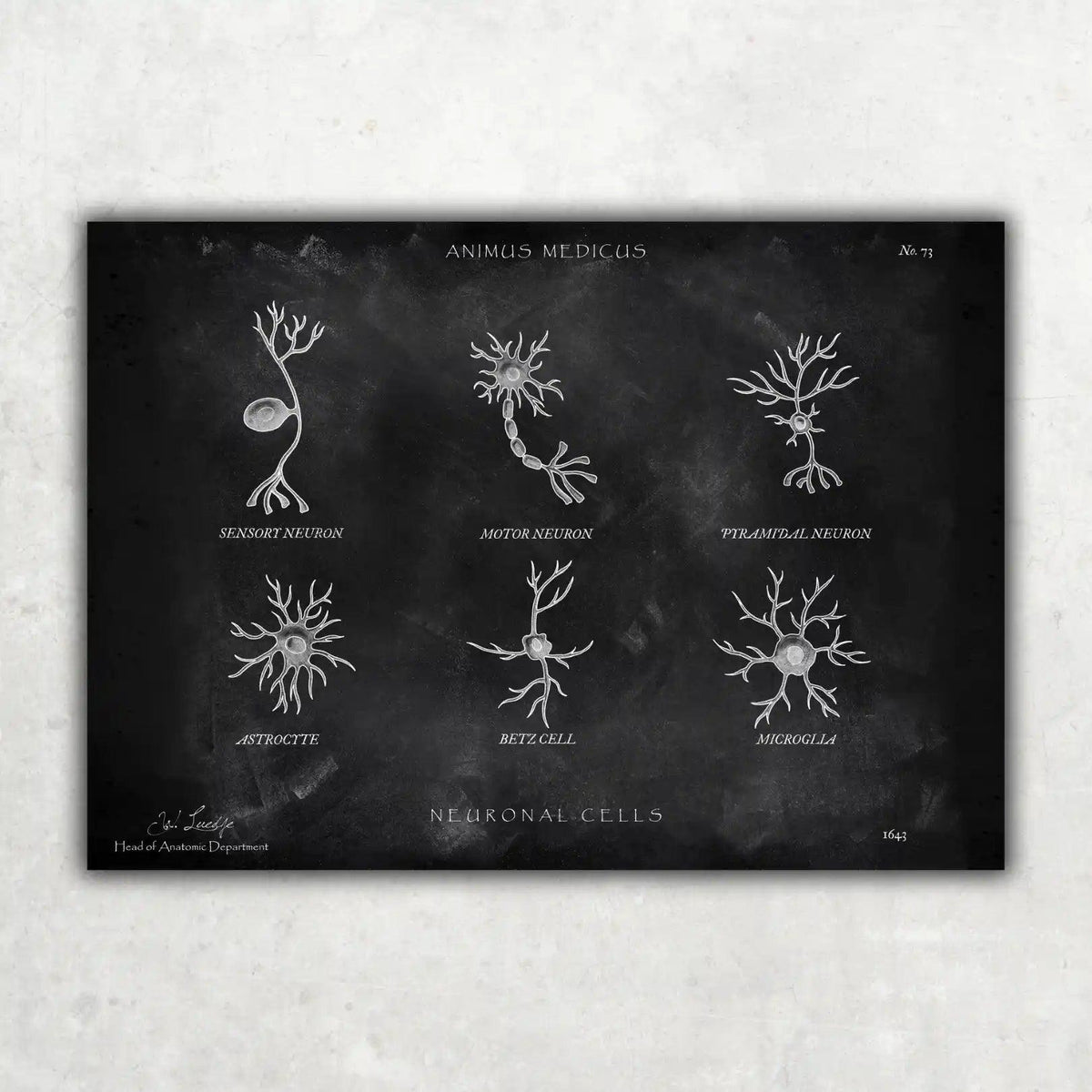Neuronale Zellen - Chalkboard - Animus Medicus GmbH