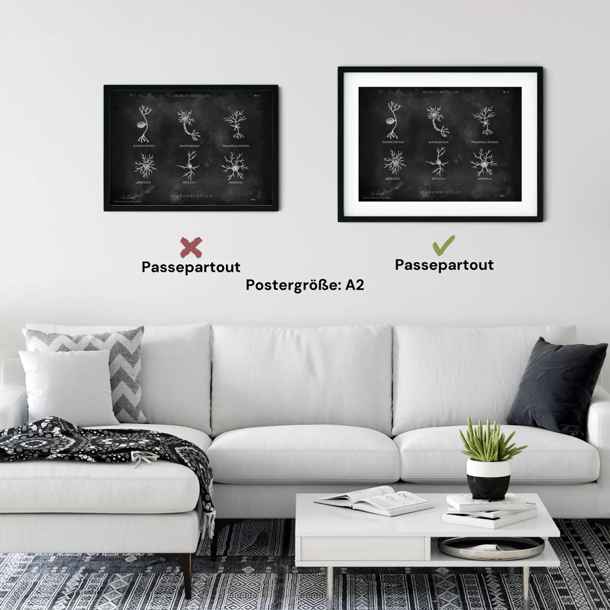 Neuronale Zellen - Chalkboard - Animus Medicus GmbH