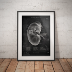 Nieren Anatomie - Chalkboard - Animus Medicus GmbH