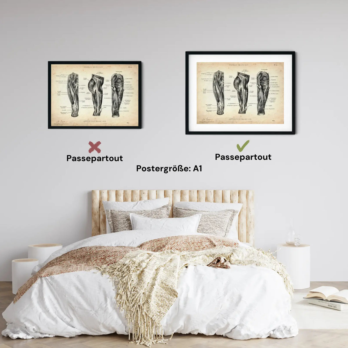 Oberschenkel Muskeln - Animus Medicus GmbH