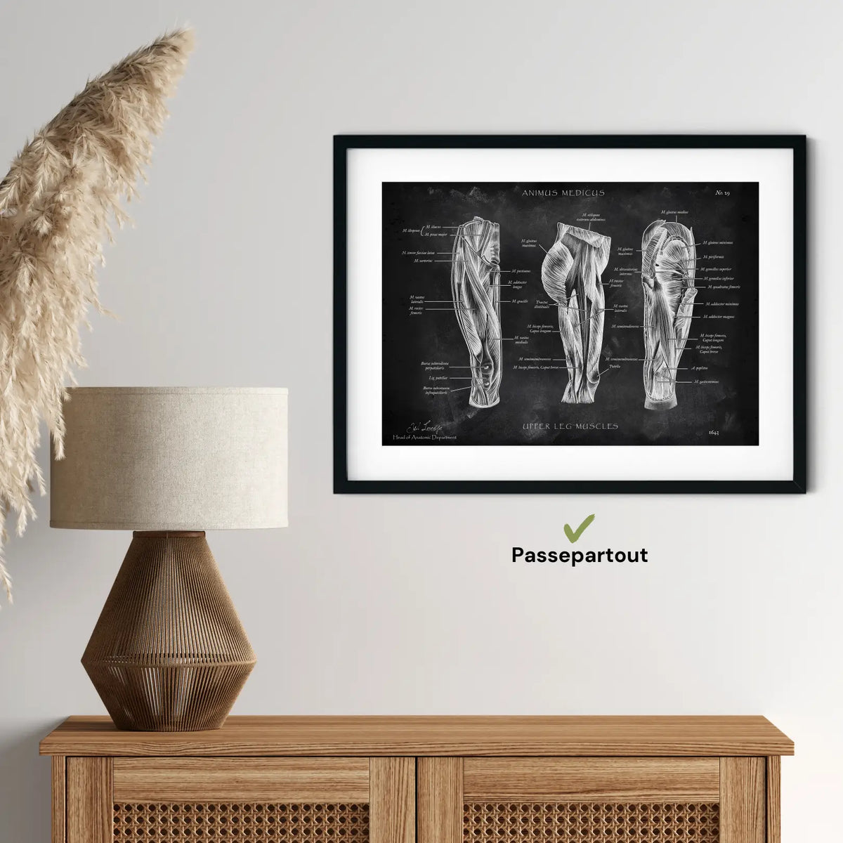 Oberschenkel Muskeln - Chalkboard - Animus Medicus GmbH