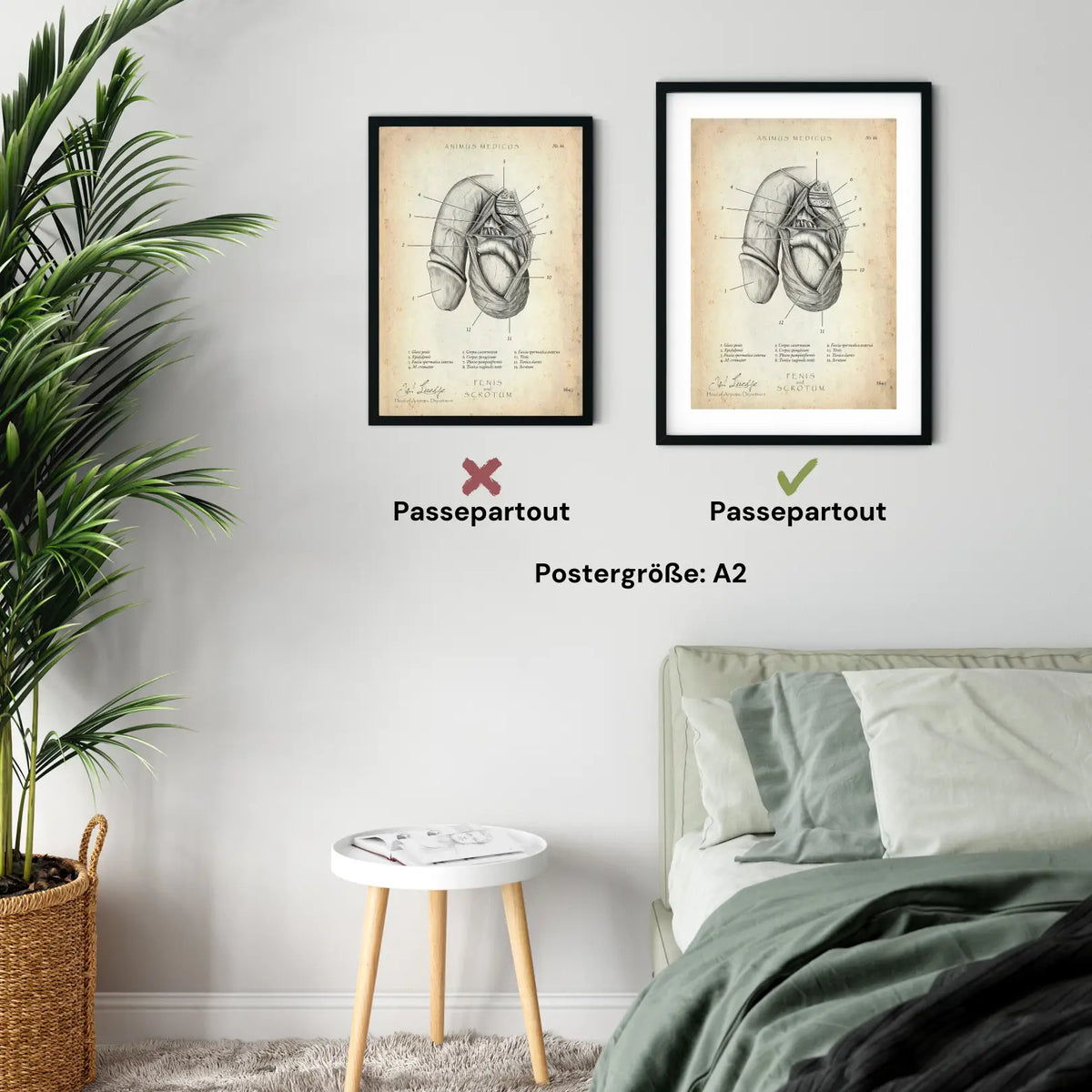 Penis mit Scrotum - Animus Medicus GmbH