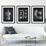 Rücken Anatomie Sammlung - Chalkboard - Animus Medicus GmbH