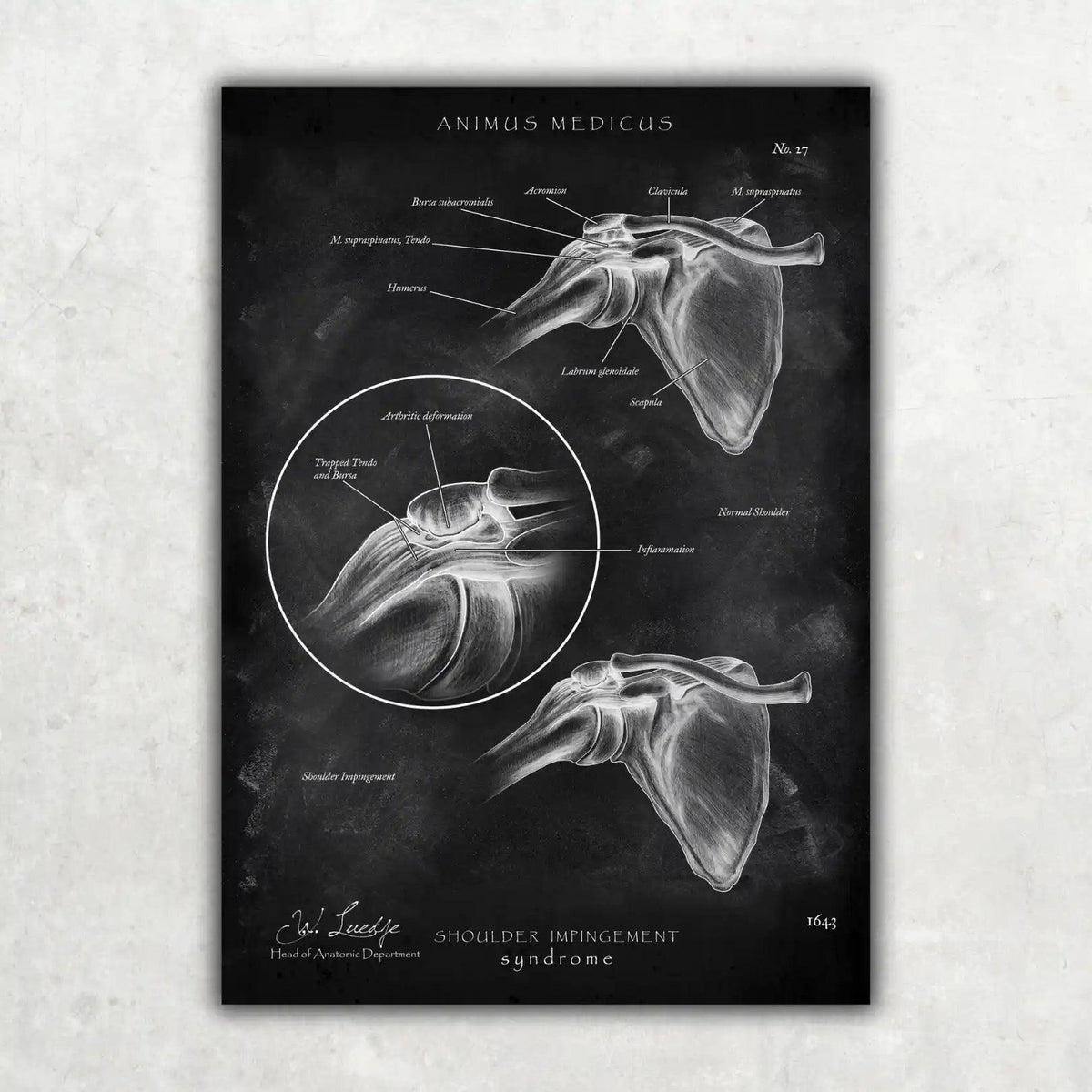 Schulter Anatomie Sammlung - Chalkboard - Animus Medicus GmbH