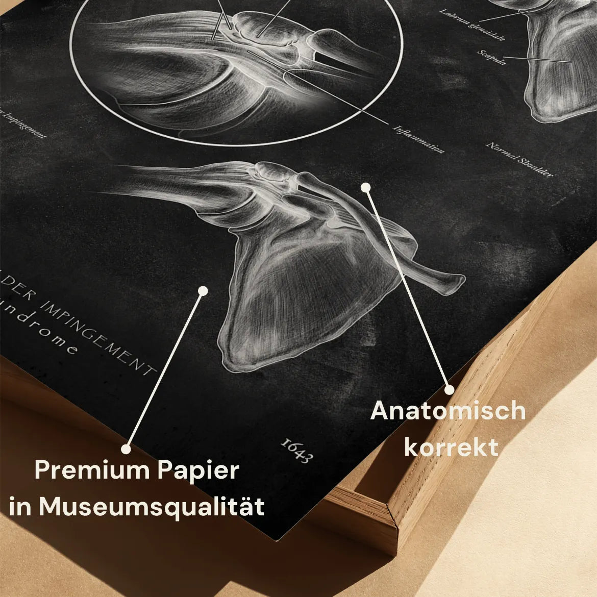 Schulter Impingement - Chalkboard - Animus Medicus GmbH
