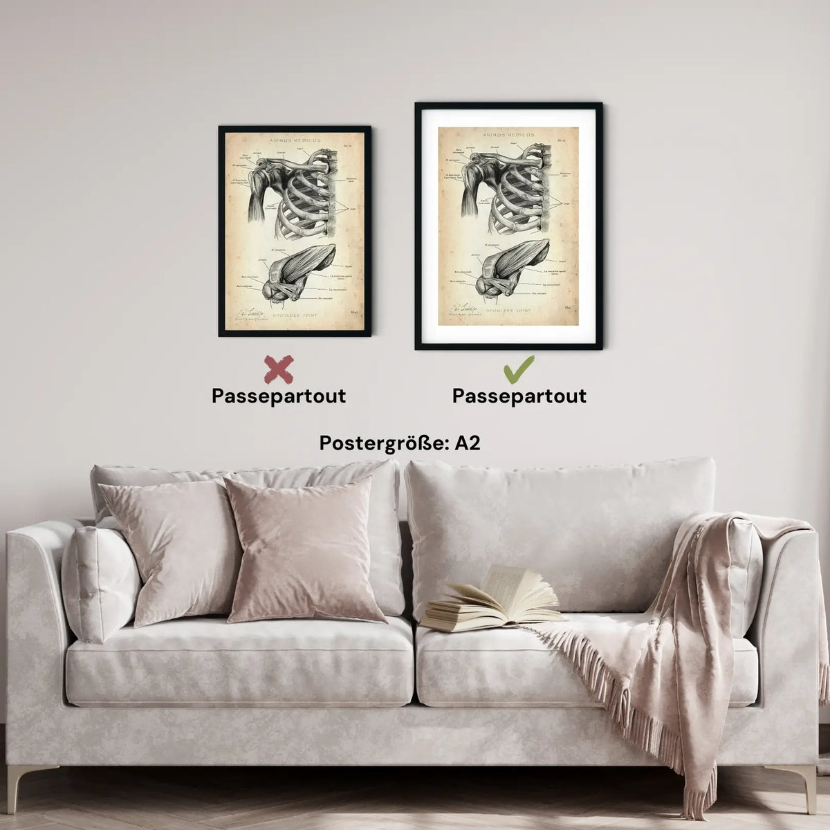 Schultergelenk Anatomie - Animus Medicus GmbH