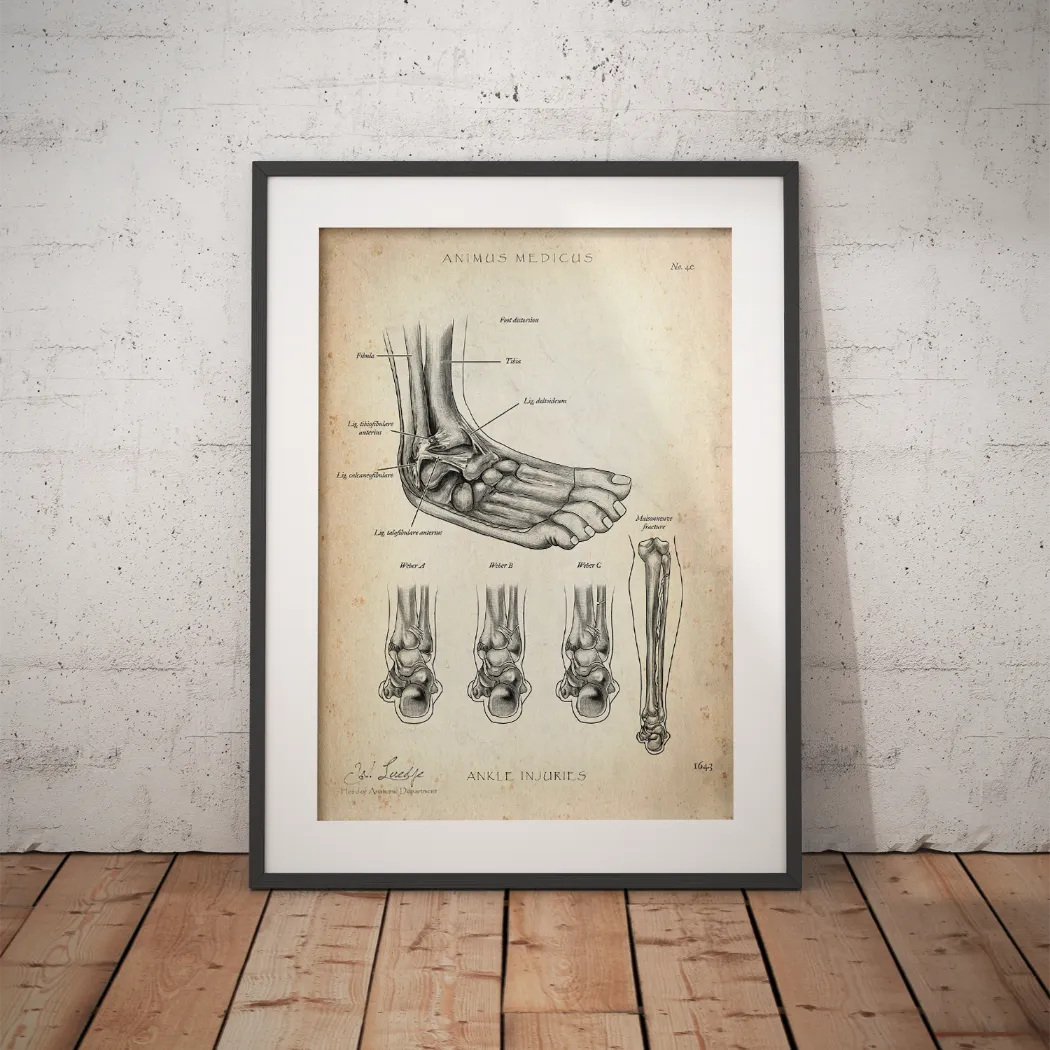 Sprunggelenk mit Bänderriss - Animus Medicus GmbH