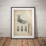 Sprunggelenk mit Bänderriss - Animus Medicus GmbH