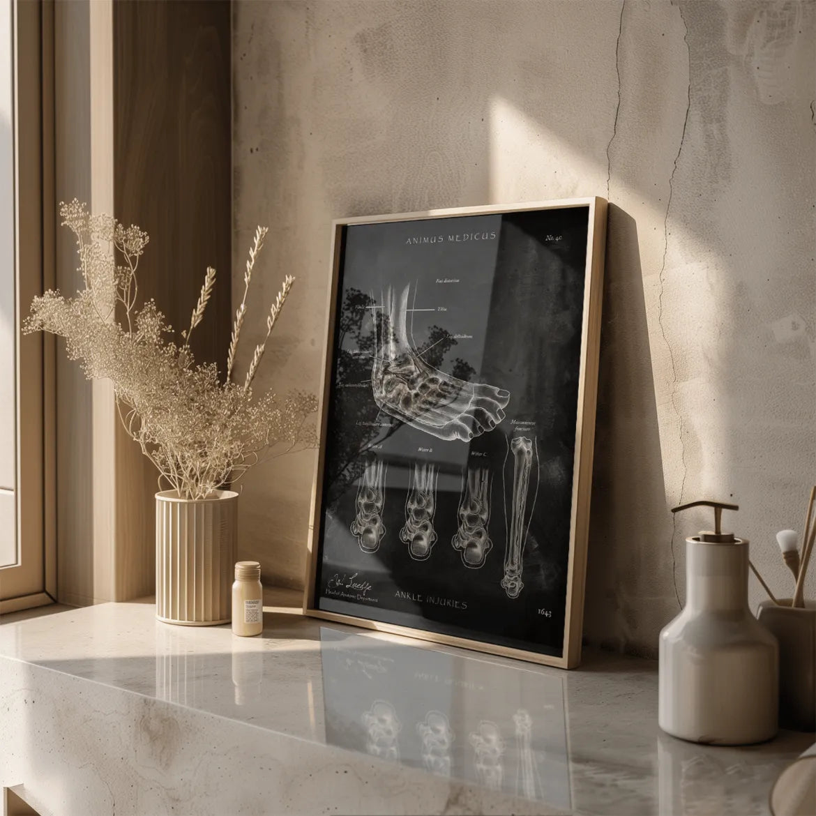 Sprunggelenk mit Bänderriss - Chalkboard - Animus Medicus GmbH