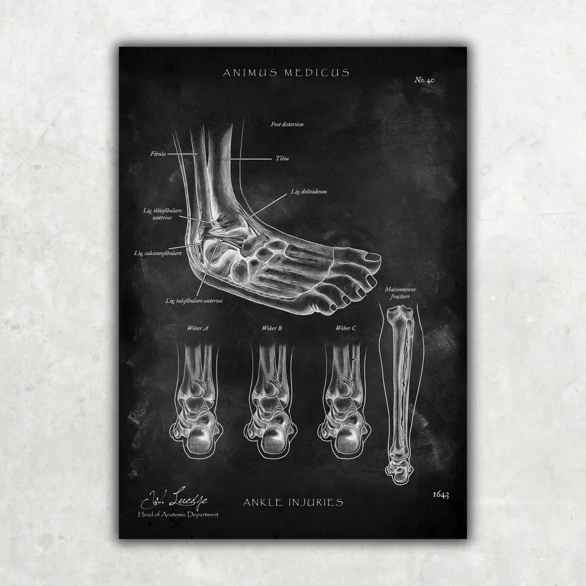 Sprunggelenk mit Bänderriss - Chalkboard - Animus Medicus GmbH
