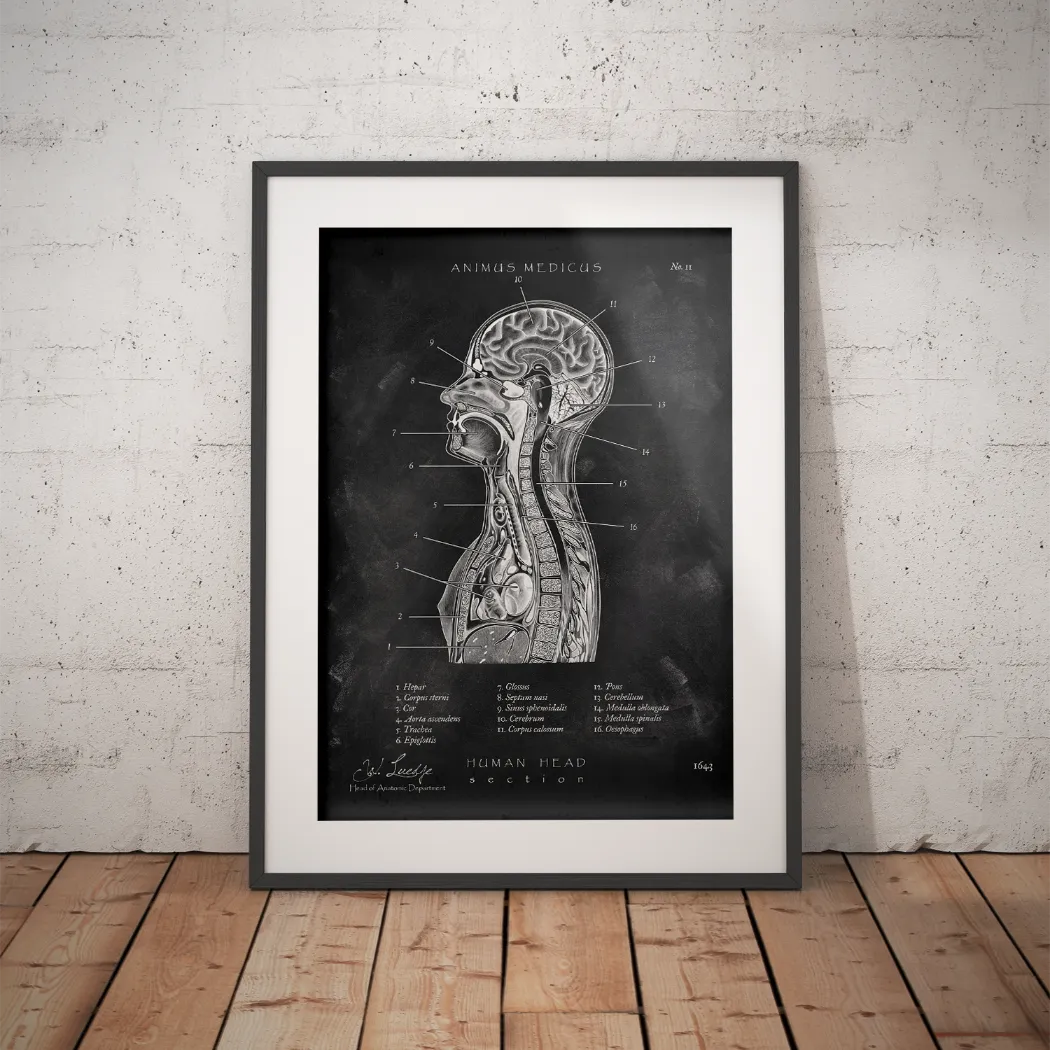 Thorax Anatomie - Chalkboard - Animus Medicus GmbH