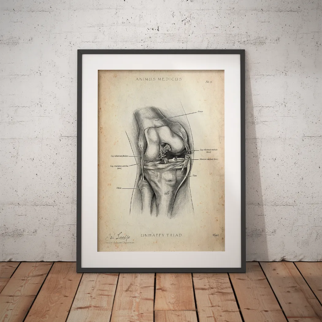 Unhappy Triad Knie - Animus Medicus GmbH