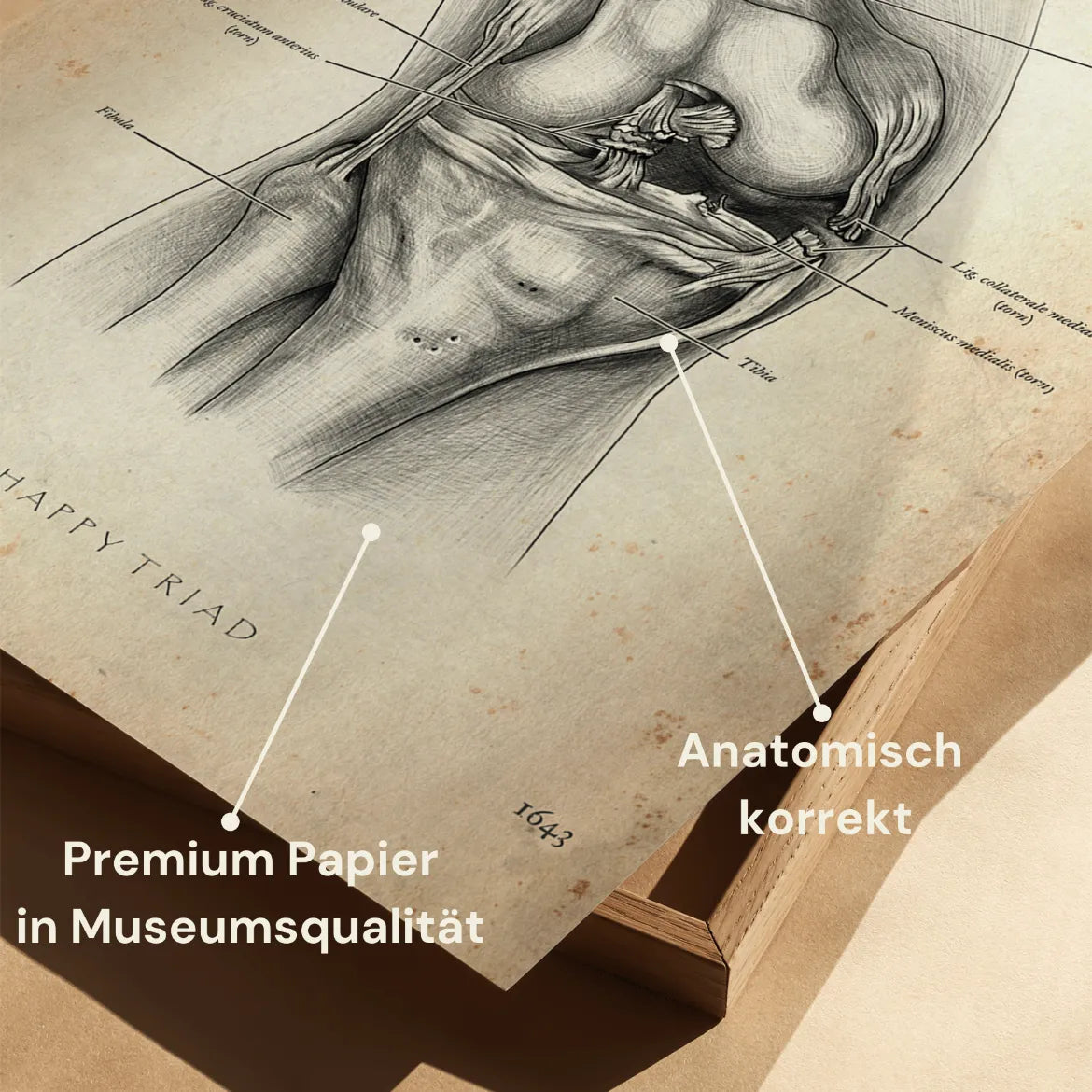Unhappy Triad Knie - Animus Medicus GmbH