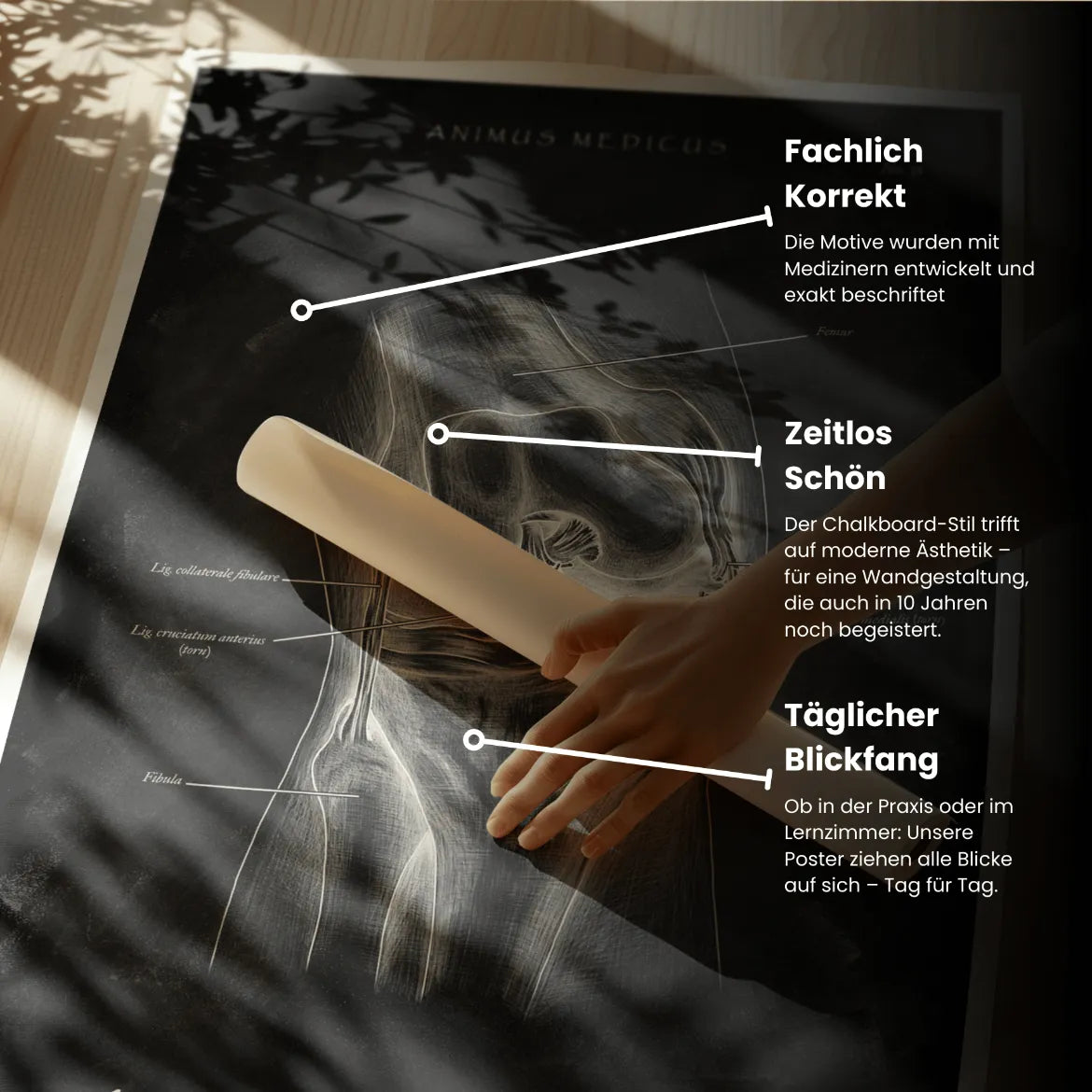 Unhappy Triad Knie - Chalkboard - Animus Medicus GmbH