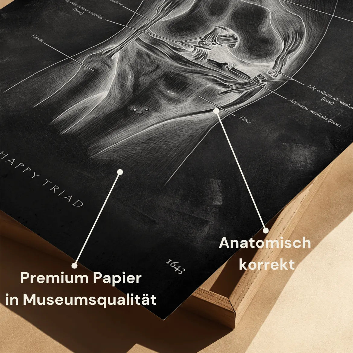 Unhappy Triad Knie - Chalkboard - Animus Medicus GmbH
