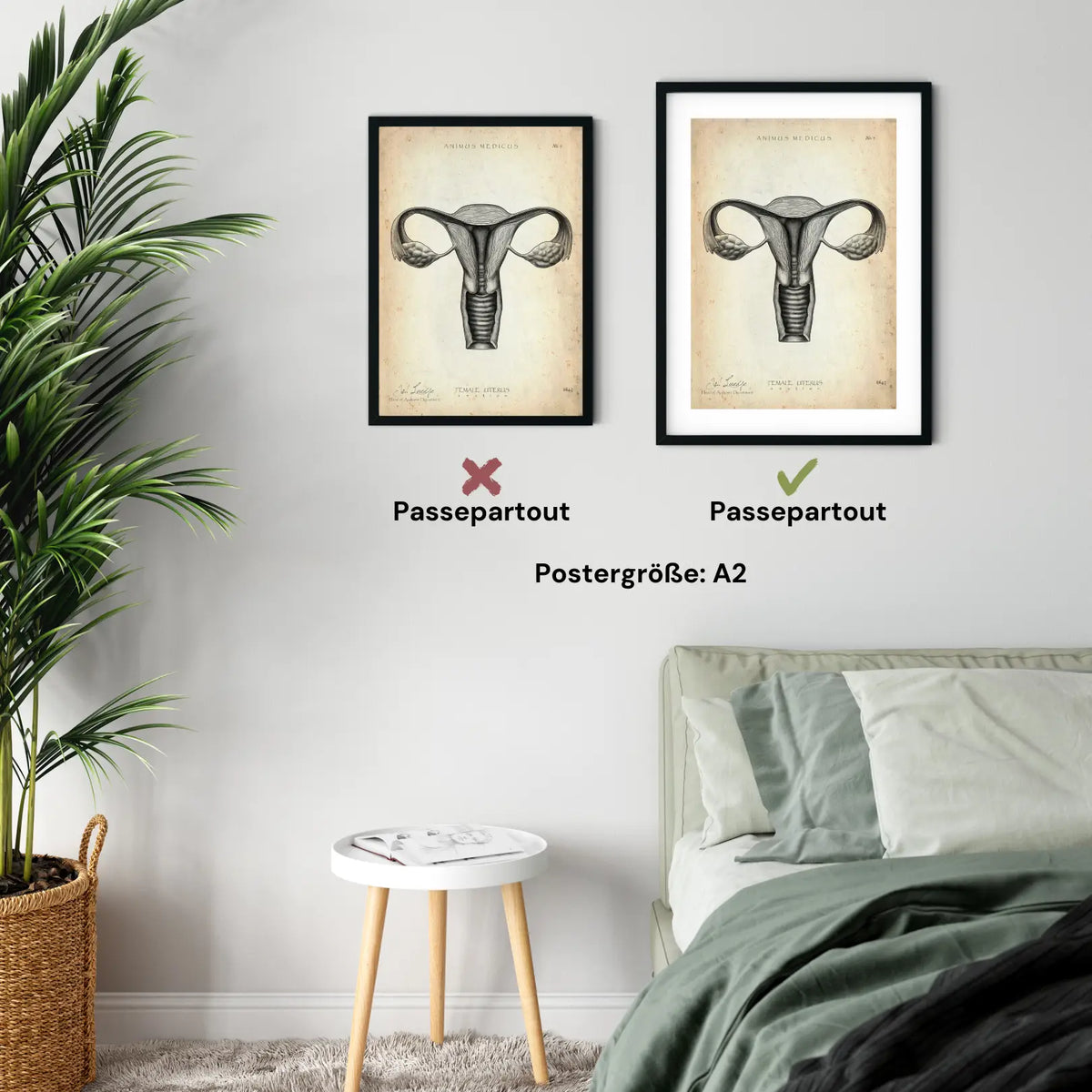 Uterus Anatomie - Animus Medicus GmbH