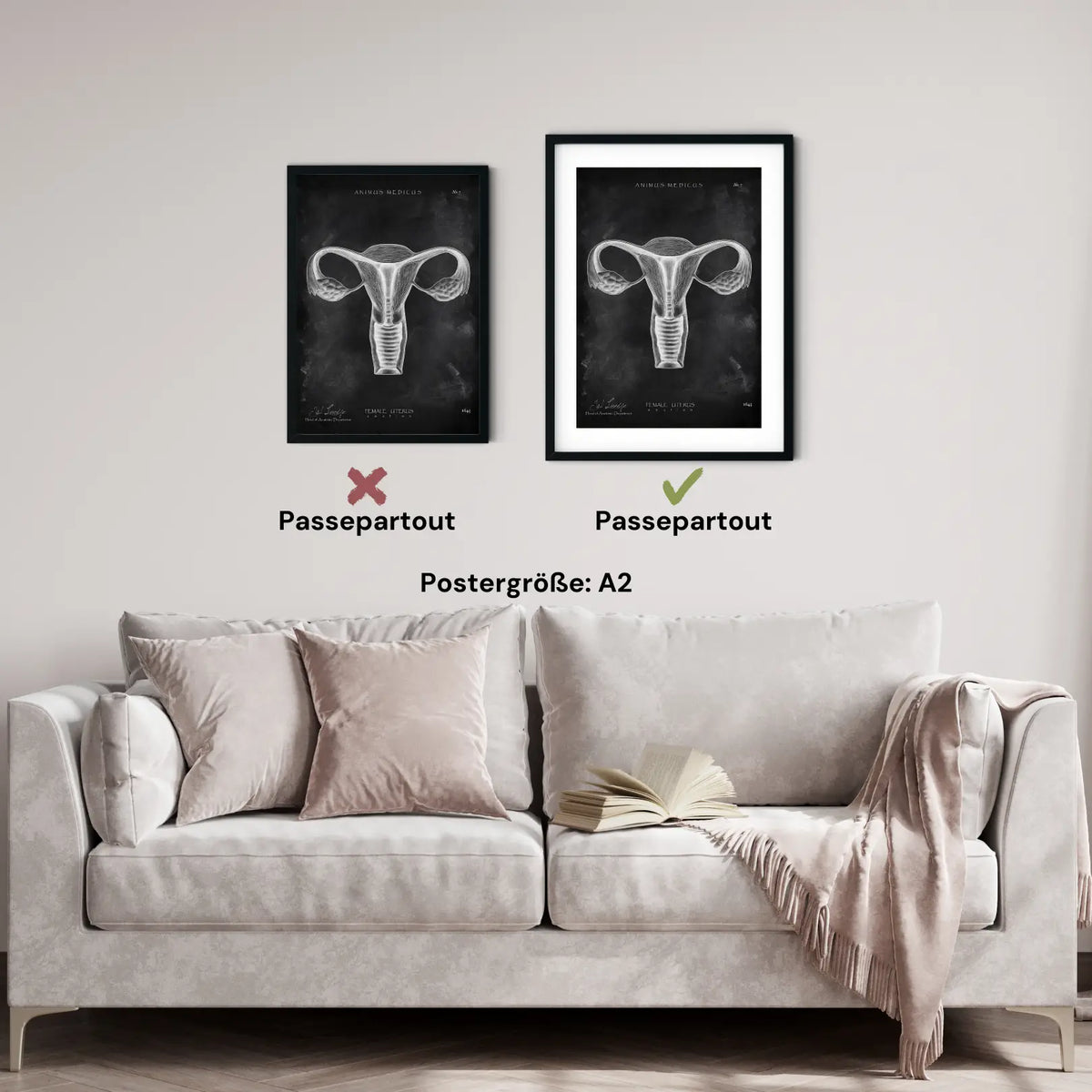 Uterus Anatomie - Chalkboard - Animus Medicus GmbH