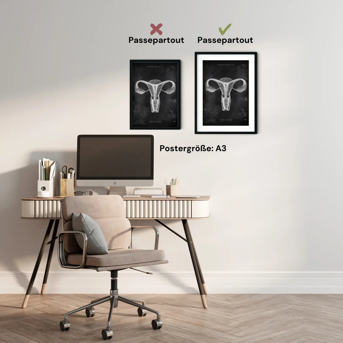 Uterus Anatomie - Chalkboard - Animus Medicus GmbH