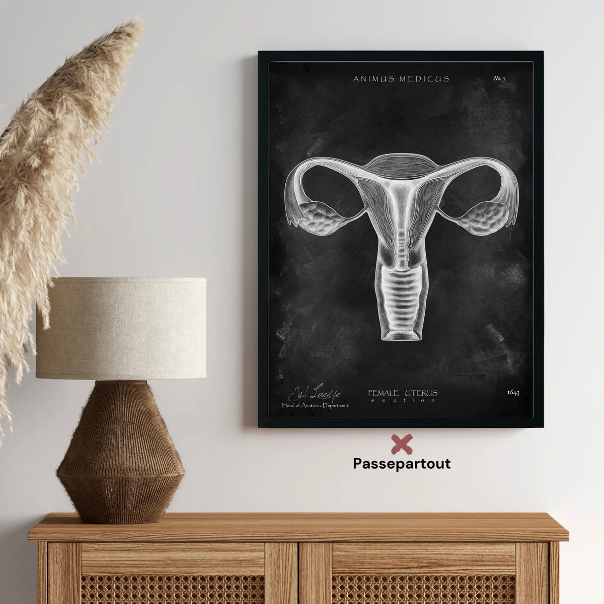 Uterus Anatomie - Chalkboard - Animus Medicus GmbH