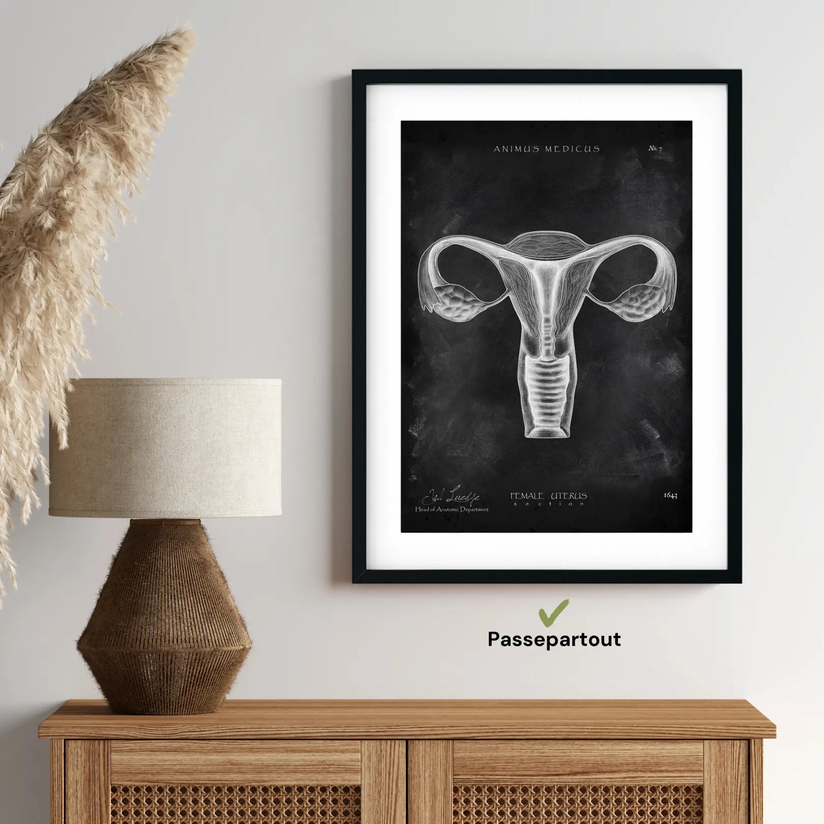Uterus Anatomie - Chalkboard - Animus Medicus GmbH